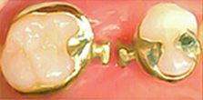 bridge_image12